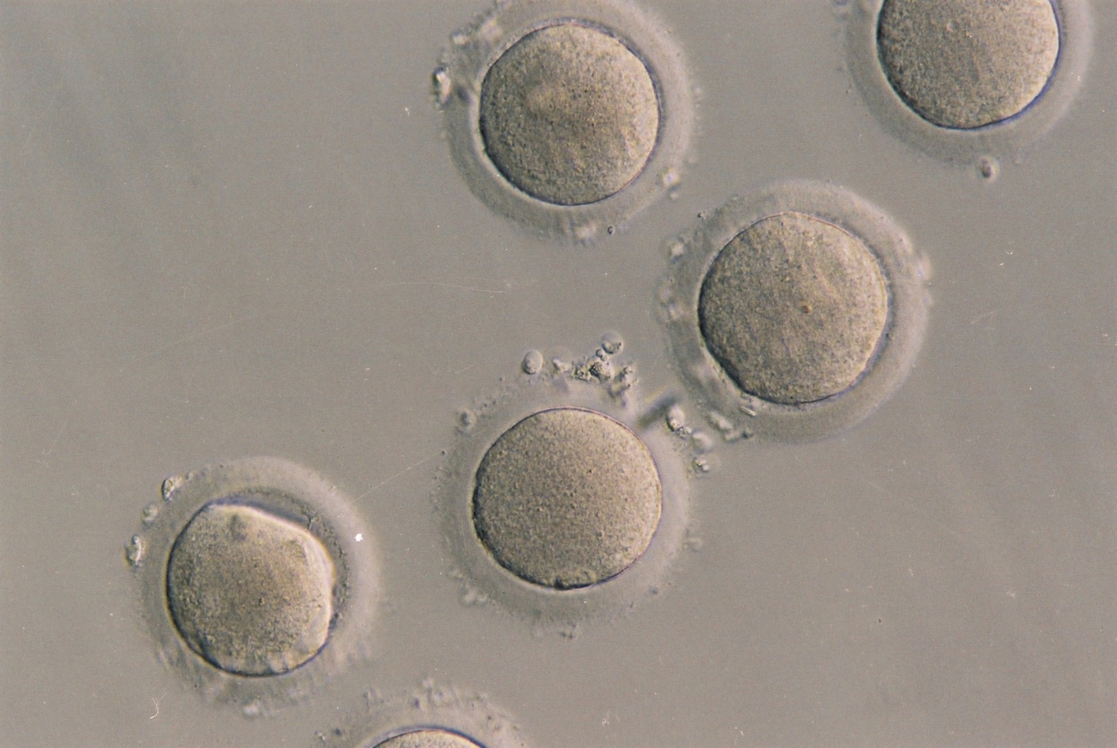 Discovery may make it easier to develop life-saving stem cells