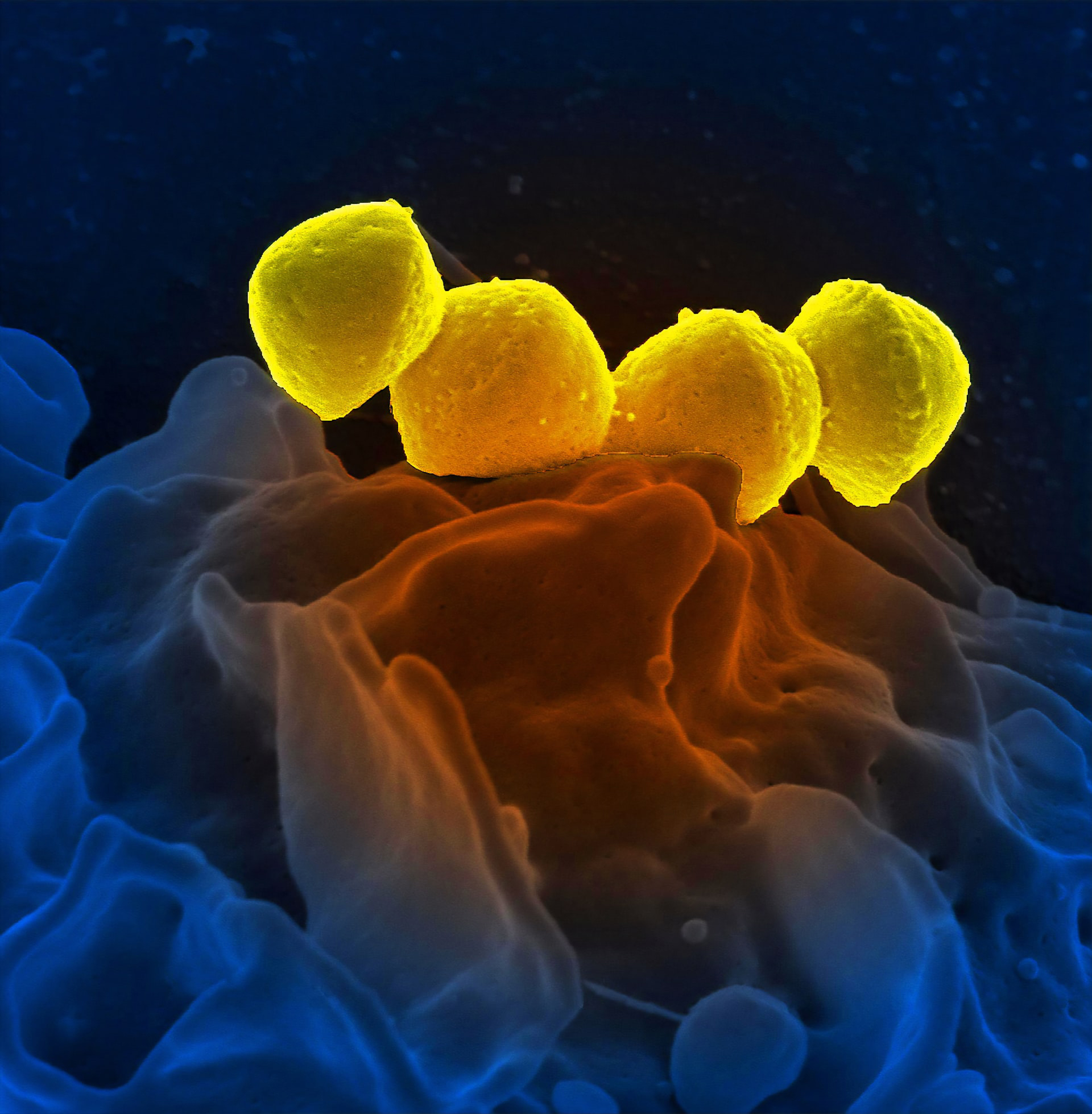 A microscope image from the CDC shows four yellow-colored orbs, which are bacteria, resting on the wavy surface of a white blood cell.