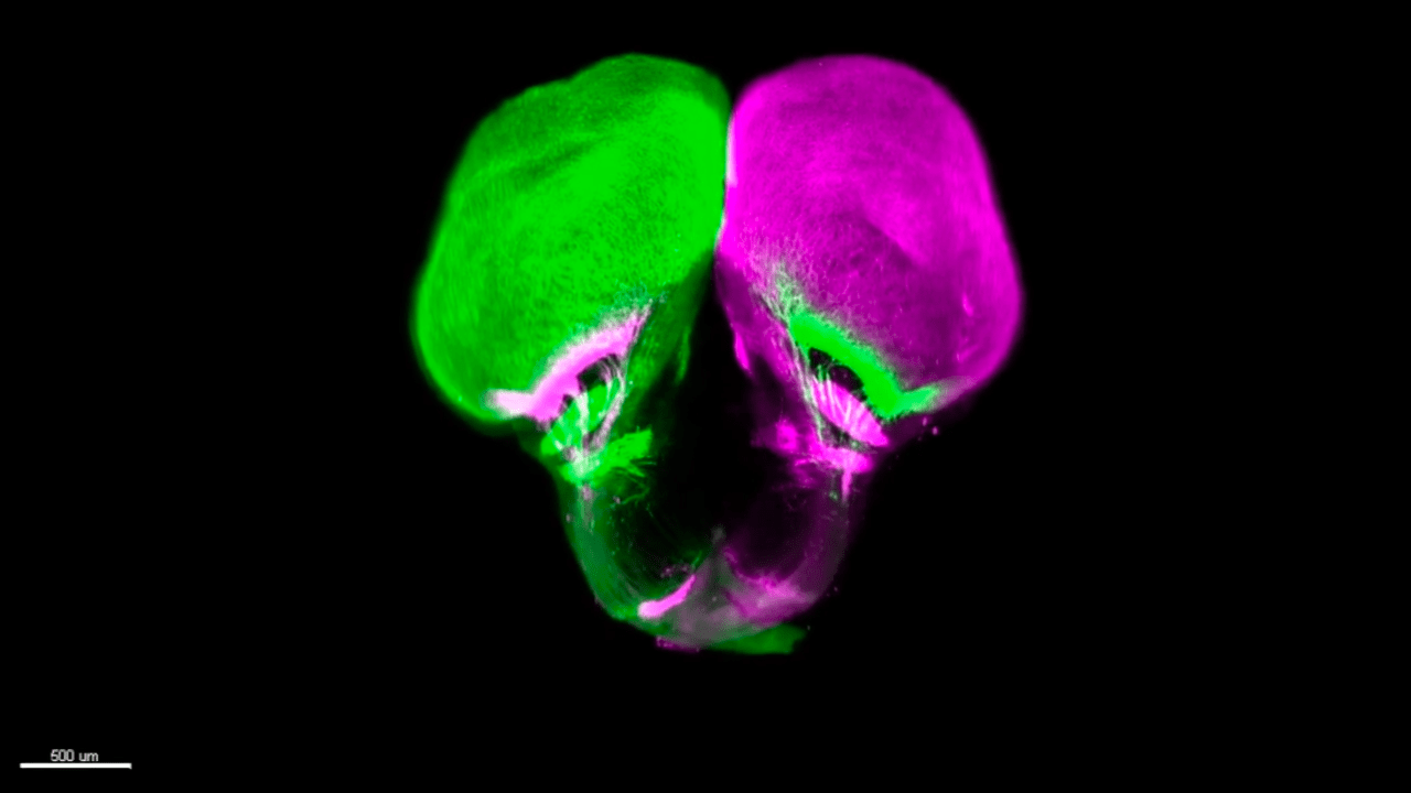 A microscope image shows a gars brain and nerves, which have been dyed green and magenta. The left hemisphere of the brain is green and the right hemisphere is magenta, but nerves of both colors connect the hemispheres to both of a gar’s eyes.