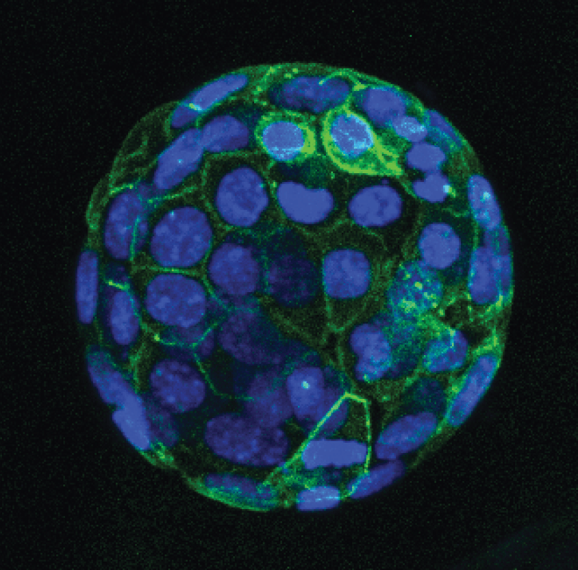 A microscope image shows an embryonic mouse cells fluorescing blue and green light. The green shows spider-web-like networks of proteins labeled by the GOGREEN system, while blue dots show individual cells and their DNA.