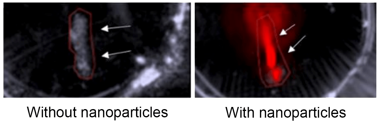 A black-and-white ultrasound image on the left shows a gray rod, which is a mouse’s artery. Two white arrows and a red outline have been added to the image to highlight the blood vessel. In the image on the right, a different artery is shown and it’s glowing red in the otherwise grayscale ultrasound image. This red signal comes from the new photoacoustic imaging, aided by nanoparticles