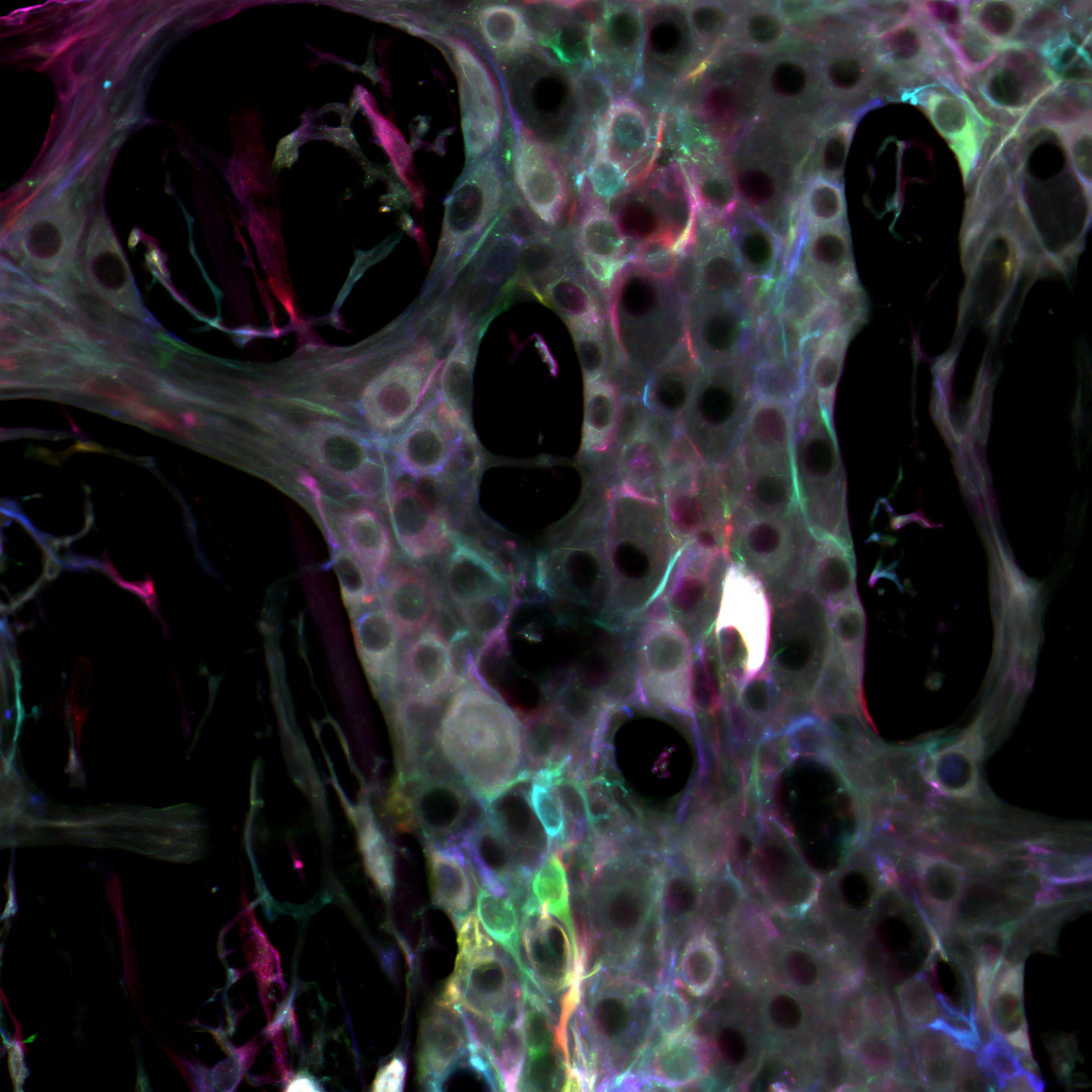 A photograph shows microscopic glial cells from the gut’s nervous system. Most cells are dark orbs with a bubbly gray border, but some have been colorized in shades of purple, pink, green and red indicating their response to a chemical signal.