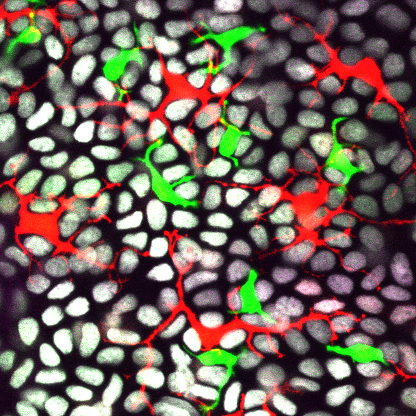 A microscope image of the skin epidermis shows an array of blob-like shapes, many of which are nuclei of epithelial cells with grayish white bean shapes. But there are also co-existing tissue-resident immune cells, labeled red (Langerhans cells) and green (dendritic epidermal T cells). Both cells have dendritic morphology that helps them surveil their environment.