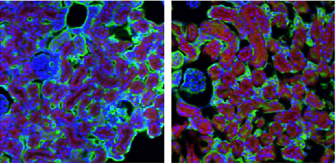 Kidney cells on the left and and kidney cells exposed to cisplatin and full of adenosine shown in red on the right.