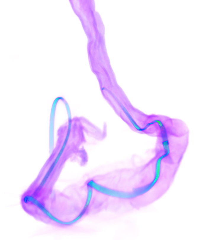 A colon is seen as a purple J-shaped structure set against a white background. Threaded through the middle of the J is a blue strand — a NeuroString sensor.
