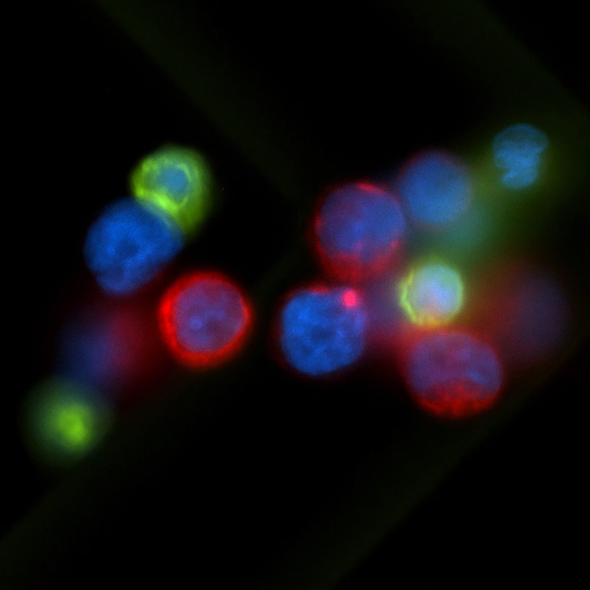 Een microfoto toont verschillende gekleurde cellen als ballen op een zwarte achtergrond.  Het midden van elke cel lijkt blauw met de kankercellen bekleed met rode en witte bloedcellen bekleed met groen.