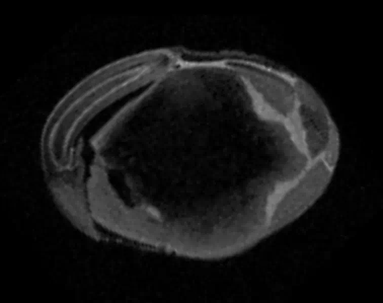 MRI of water rehydrating a soybean
