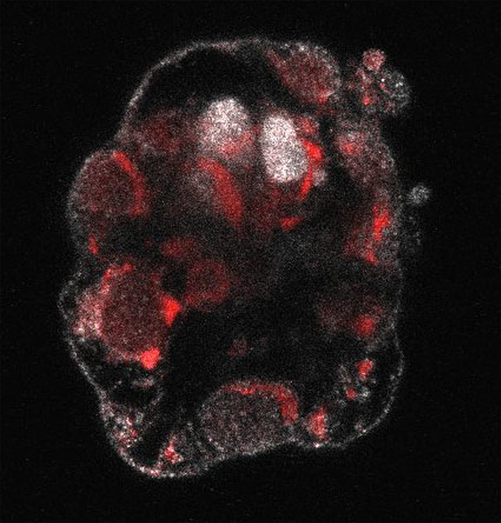 A micrograph shows a clumpy gray collection of epiblast cells — cells that would normally grow into a fetus — that are infected with Zika virus, seen as red splotches in the image.