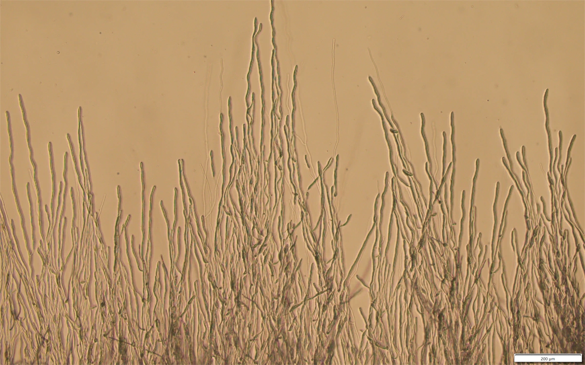 Rod-shaped microorganisms sprout like blades of grass from the bottom of a microscope image toward the top.