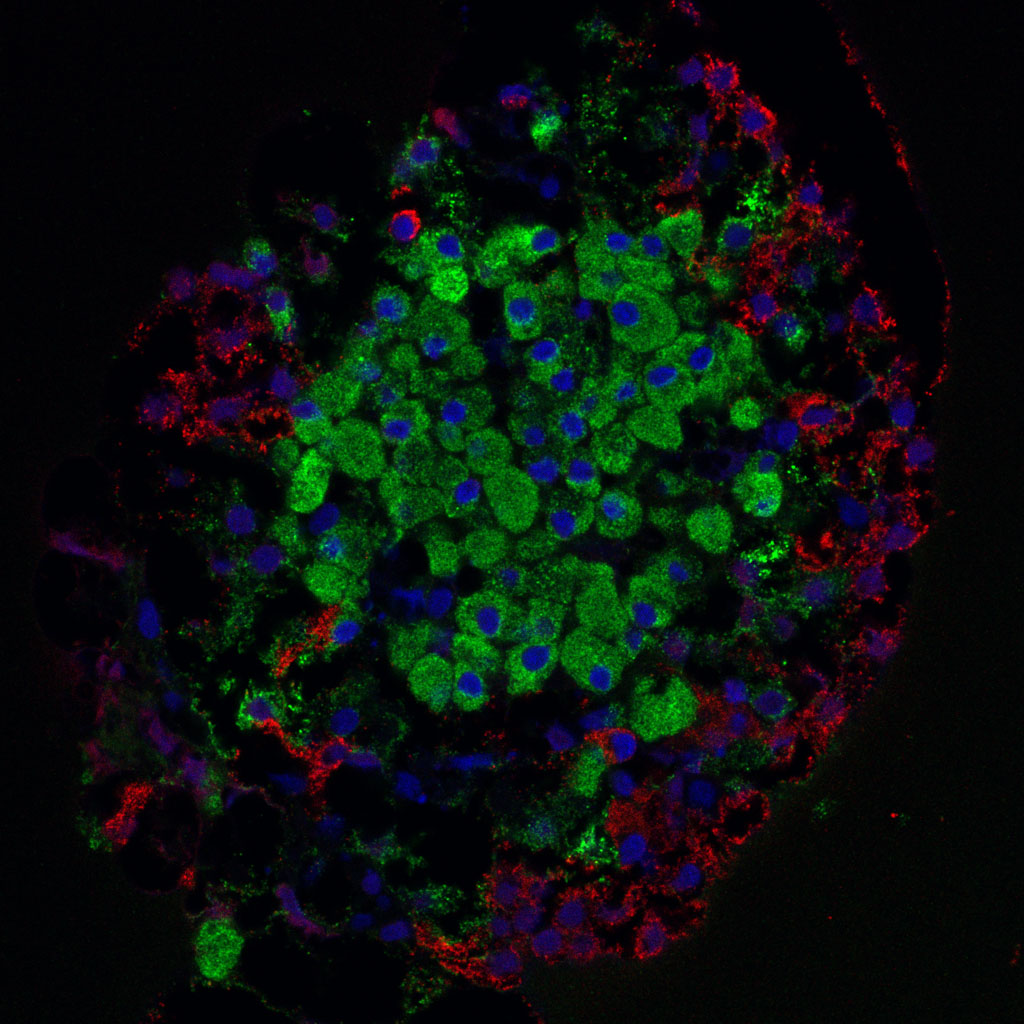 A microscope image shows alpha cells in red around the circumference of a pancreatic islet isolated from a rat. Inside the islet, beta cells are seen in green. 